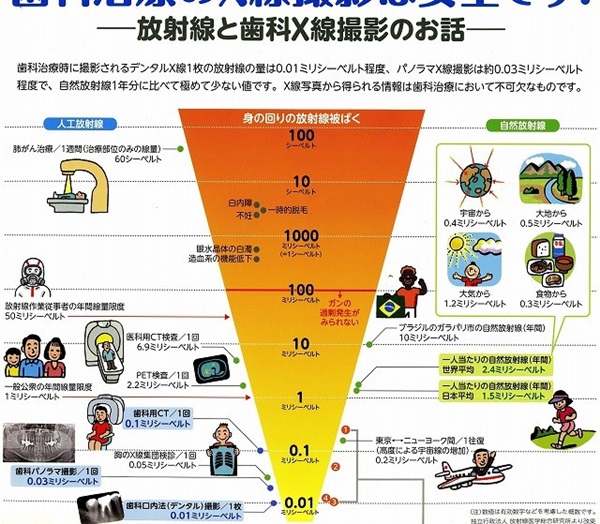 レントゲン