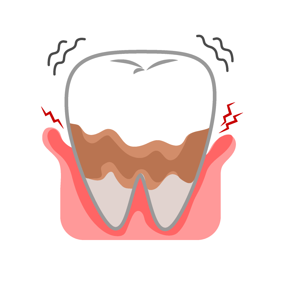 前歯がギザギザなのは何故？ギザギザの場合の対処法と考えられる病気を解説 | 大崎の歯科・歯医者【大崎シティデンタル】丁寧で痛くない治療