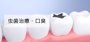 虫歯治療・口臭）