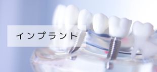 インプラント