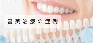審美治療の症例