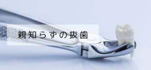親知らずの抜歯