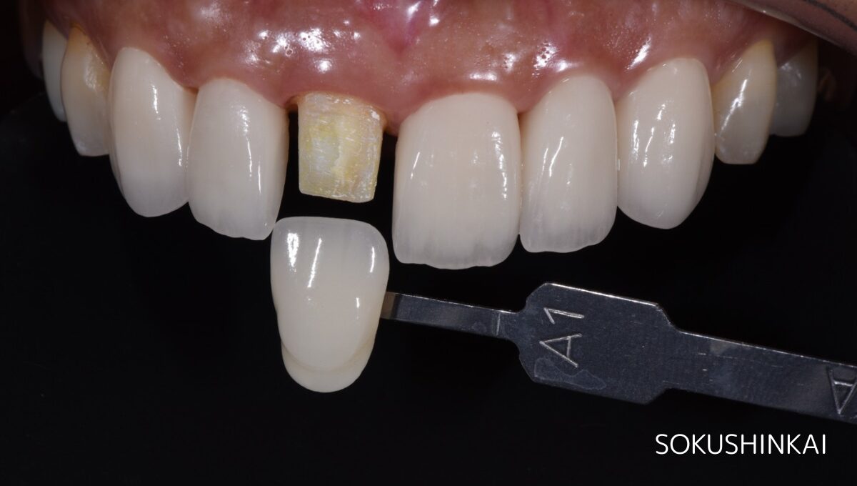 こだわりを反映