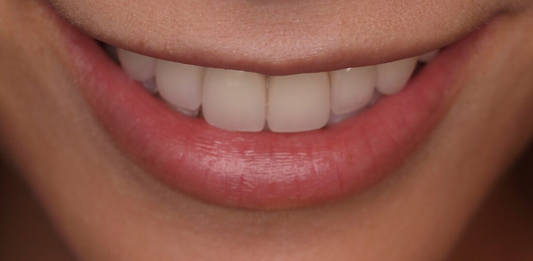 審美治療サービスページ