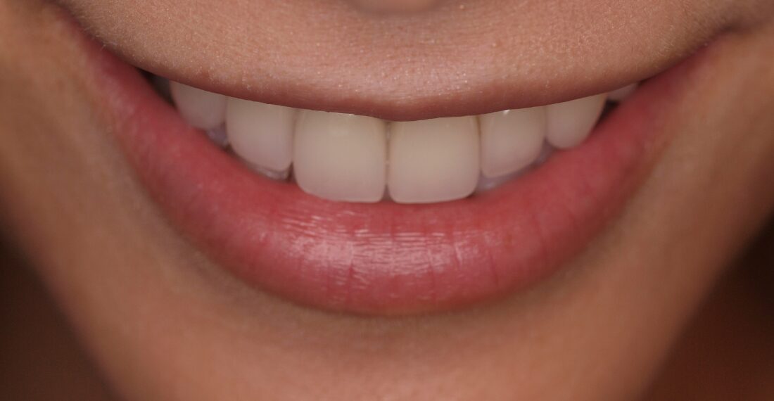 審美治療 | 大崎シティデンタルクリニック